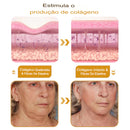 Botox BeeVenom - Creme Remoção de Rugas ( COMPRE 1 LEVE 2 )
